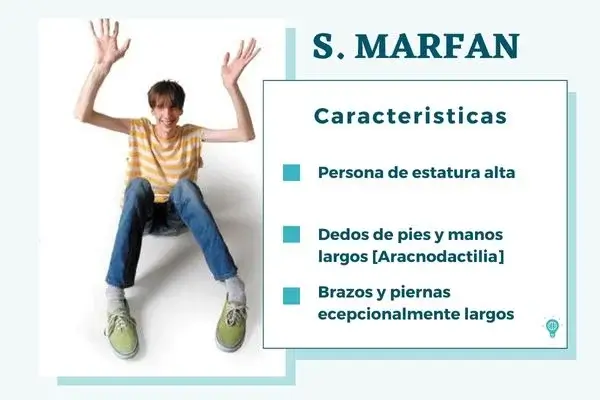 sindrome de marfan, imagen de un paciente