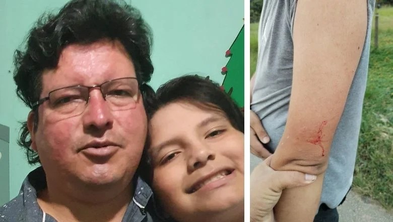 Alergias al polvo de tejidos y gluten